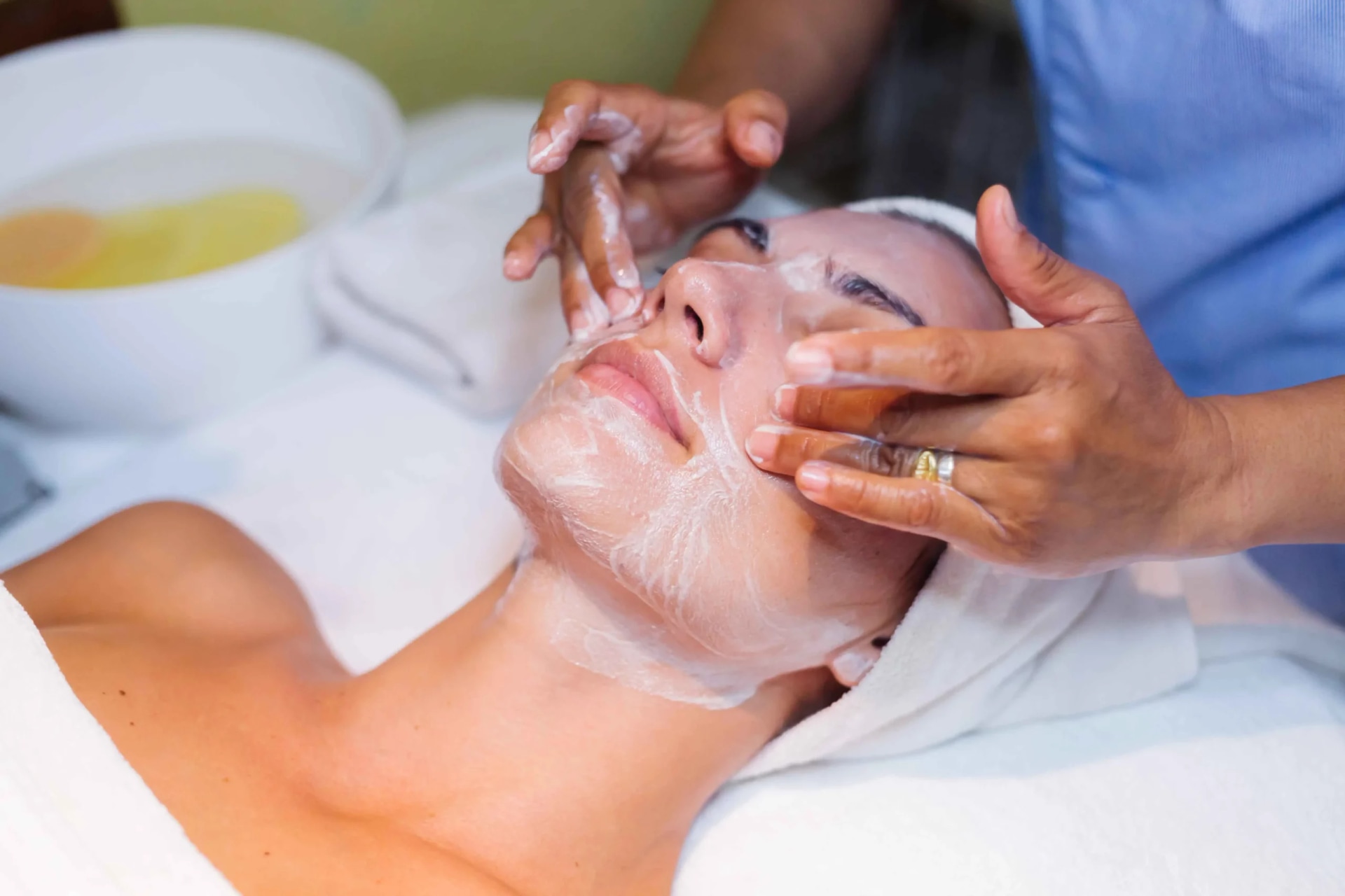 Natürlich schöne Ergebnisse mit stylage filler bei MorySkin