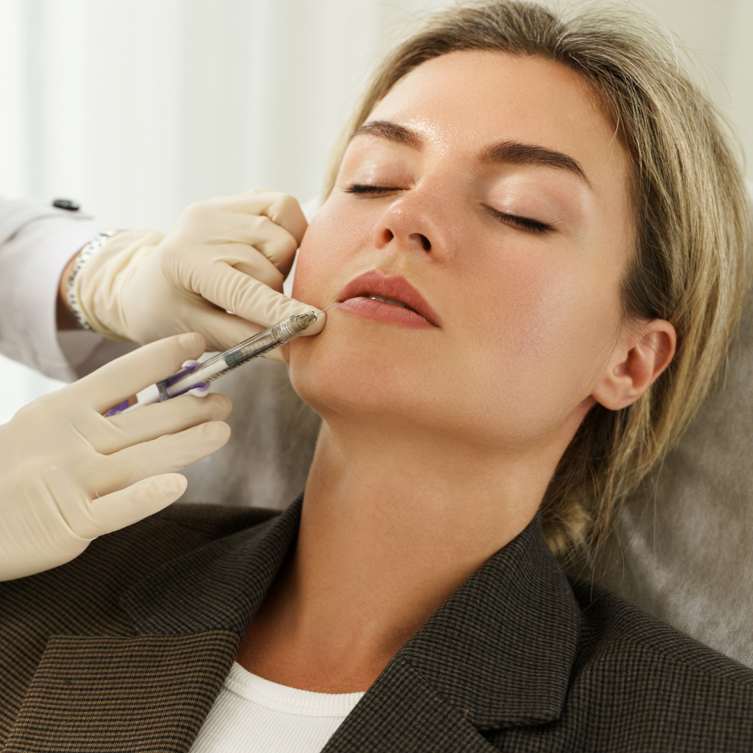 Natürlich schöne Ergebnisse mit stylage filler bei MorySkin