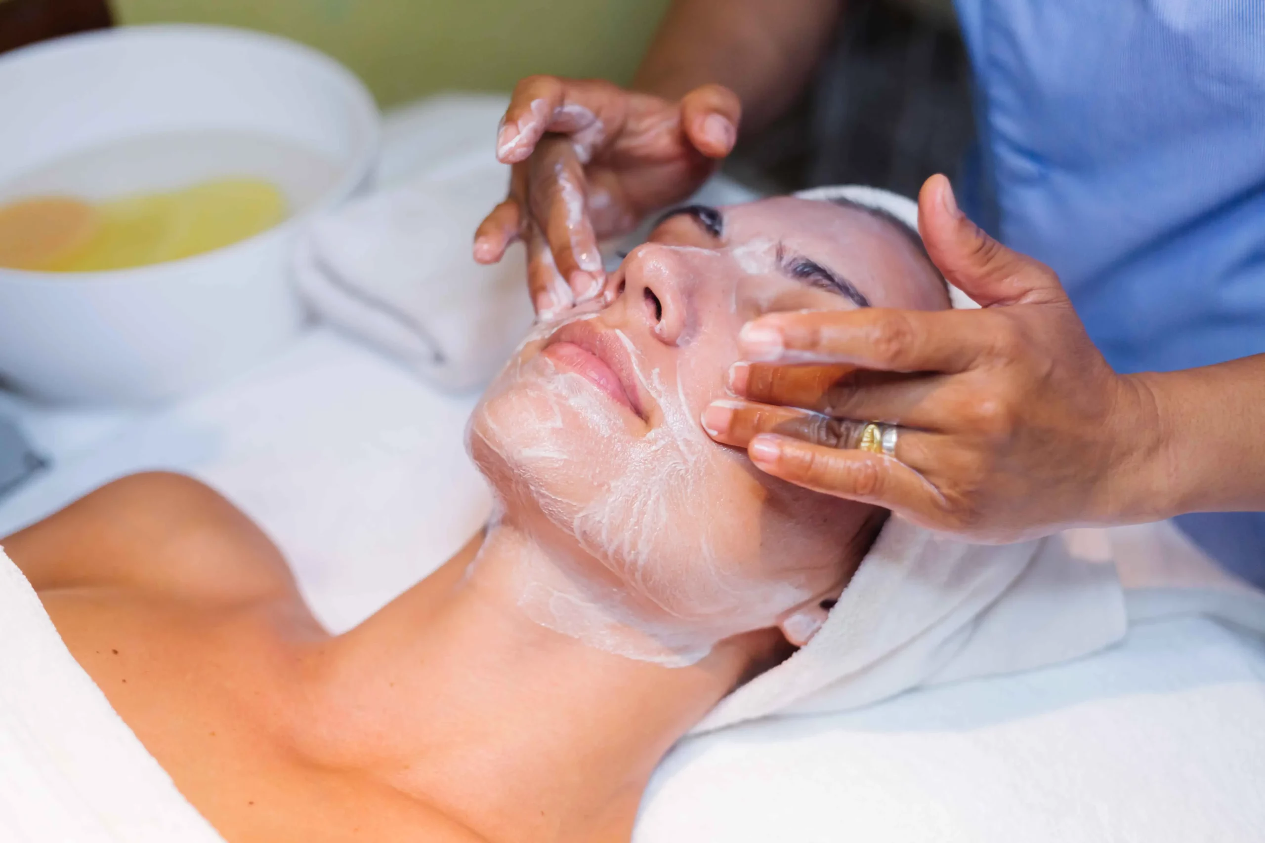 Natürlich schöne Ergebnisse mit stylage filler bei MorySkin